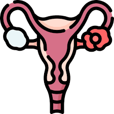Ovarian Cancer illustration 1