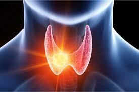 Thyroid Cancer illustration 1