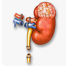 Urologic Oncology Surgery illustration 4