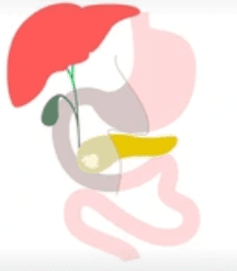 Whipple Procedure illustration 2