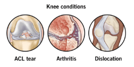 Arthroscopy (Knee & Shoulder) illustration 2