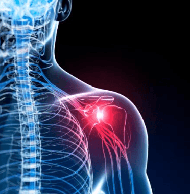 Rotator Cuff Repair illustration 1
