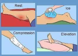Sports Injuries illustration 2