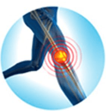 Orthopaedic Trauma illustration 2